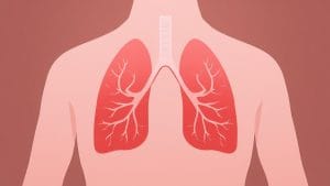 Lung Cancer Trial Finds Higher Disease-Free Survival Rate With ALK Inhibitor Ensartinib, Study Shows