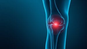 New Drug Combination Eases Relapsed Joint Condition, Trial Finds