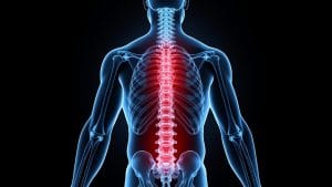 Spinal Mass Found in Man Admitted for Abdominal Pain, MGH Case Record Shows